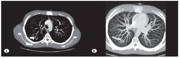 purchase biaxin online